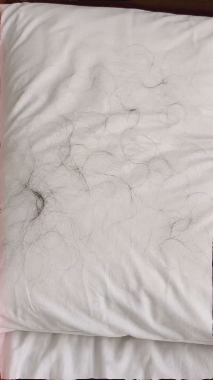 Slovic Scalp Massager